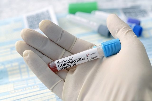 Coronavirus Test Photo courtesy of BigStock/diy13