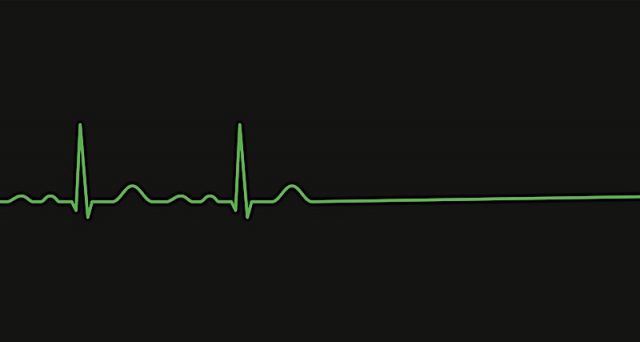 Heartbeat EKG Photo courtesy of BigStock/rootstocks
