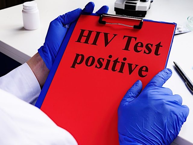 Doctor Holds Hiv Test Positive And Clipboard. Hiv/aids Concept. Photo courtesy of BigStock/designer491